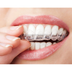 Ogreen-44-CP-Professional-Teeth-Whitening-Kit-Bleaching-System-Bright-White-Smiles-Teeth-Whitening-Gel